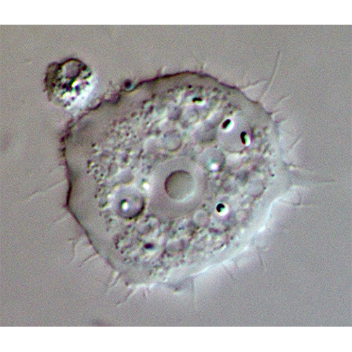 Семейство Acanthamoebidae фото