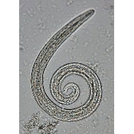 Семейство Angiostrongylidae  фото