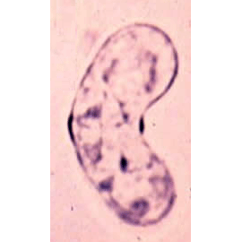Семейство Ceratomyxidae  фото
