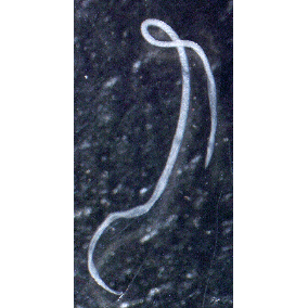 Семейство Cystidicolidae  фото