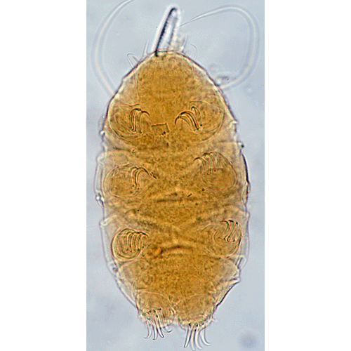 Отряд Echiniscoidea фото