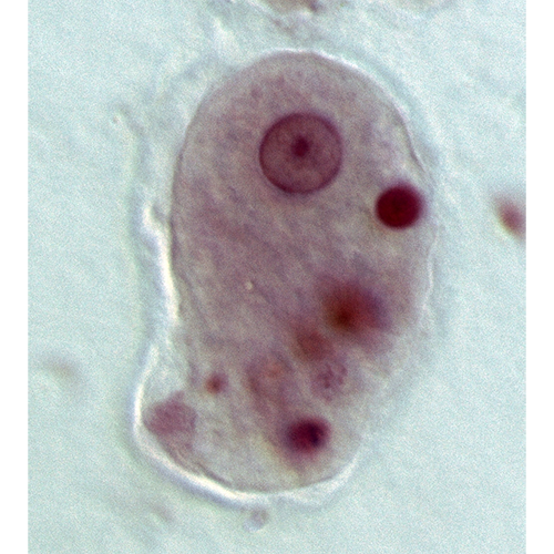 Семейство Entamoebidae фото