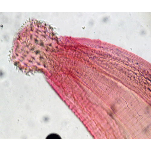 Семейство Gnathostomatidae  фото