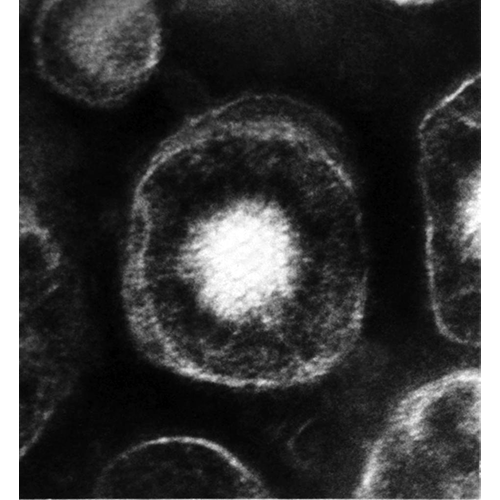 Тип Herpesvirales фото