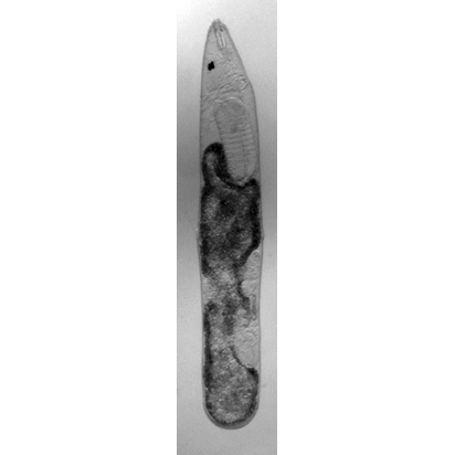 Семейство Karkinorhynchidae  фото