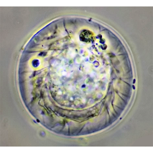 Семейство Microchlamyiidae фото