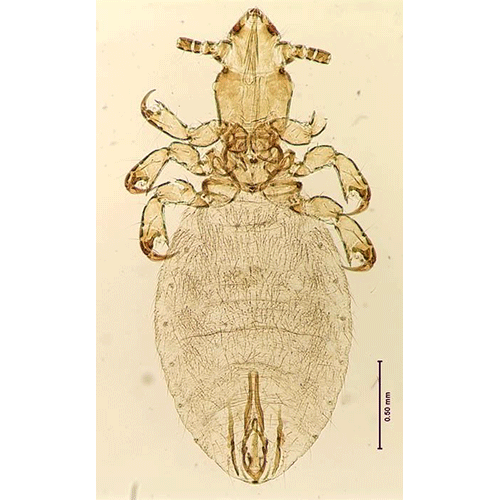 Семейство Microthoraciidae фото