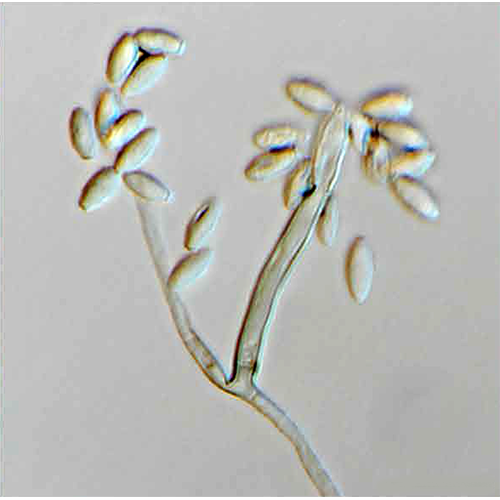 Отряд Pararamichloridiales фото