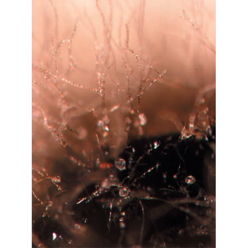Отряд Parasympodiellales фото