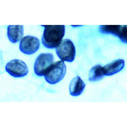 Отряд Pneumocystales фото