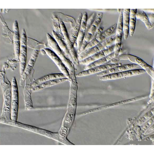 Отряд Pseudodactylariales фото