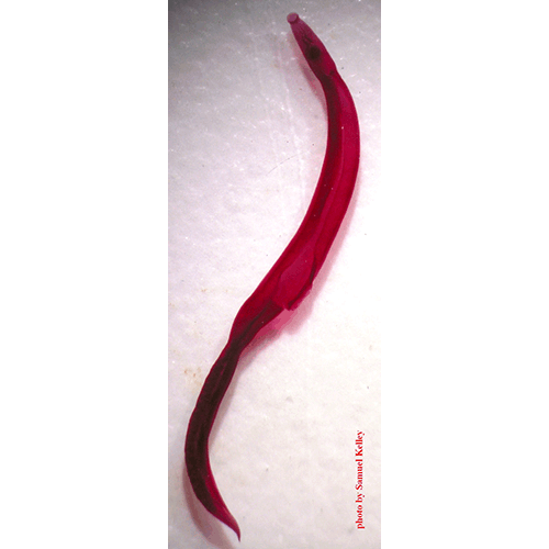 Семейство Schistosomatidae  фото