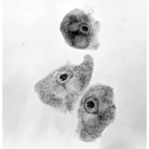 Отряд Schizopyrenida фото