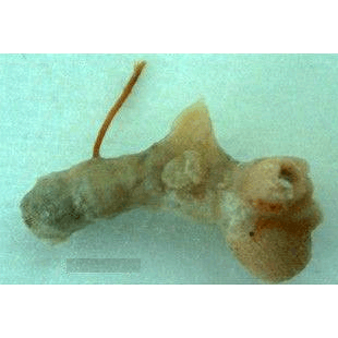 Семейство Spirasigmidae  фото