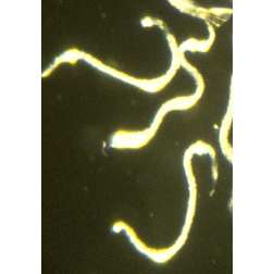 Семейство Steinernematidae  фото