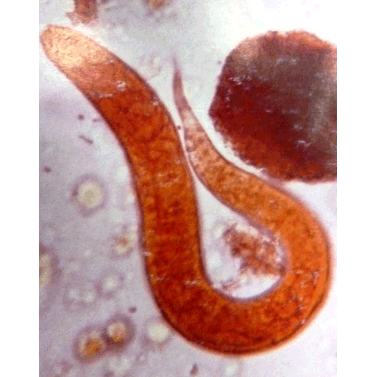 Семейство Strongyloididae  фото