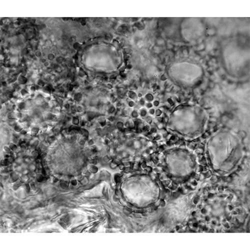 Отряд Talbotiomycetales фото