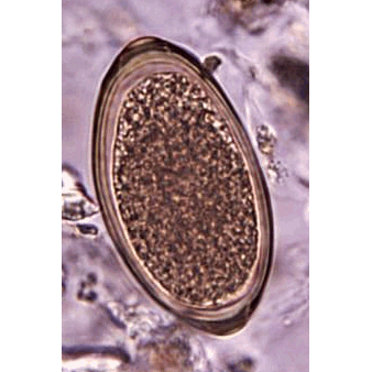 Семейство Trichuridae  фото