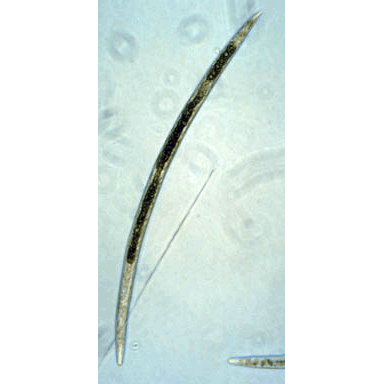 Семейство Tylenchidae  фото