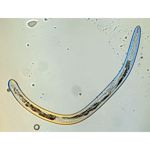Семейство Tylencholaimellidae  фото