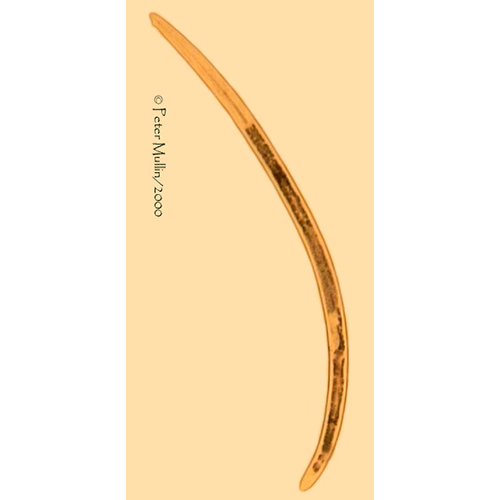 Семейство Tylencholaimidae  фото