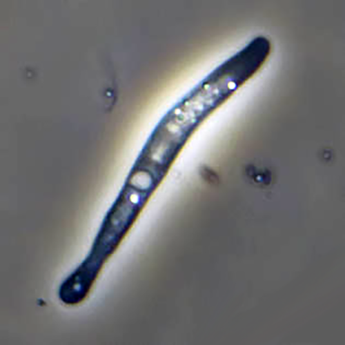 Семейство Vermamoebidae фото