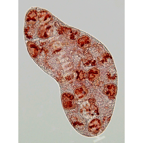 Семейство Zoogonidae фото